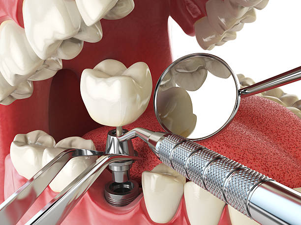 Best Pediatric Emergency Dentist in Teutopolis, IL
